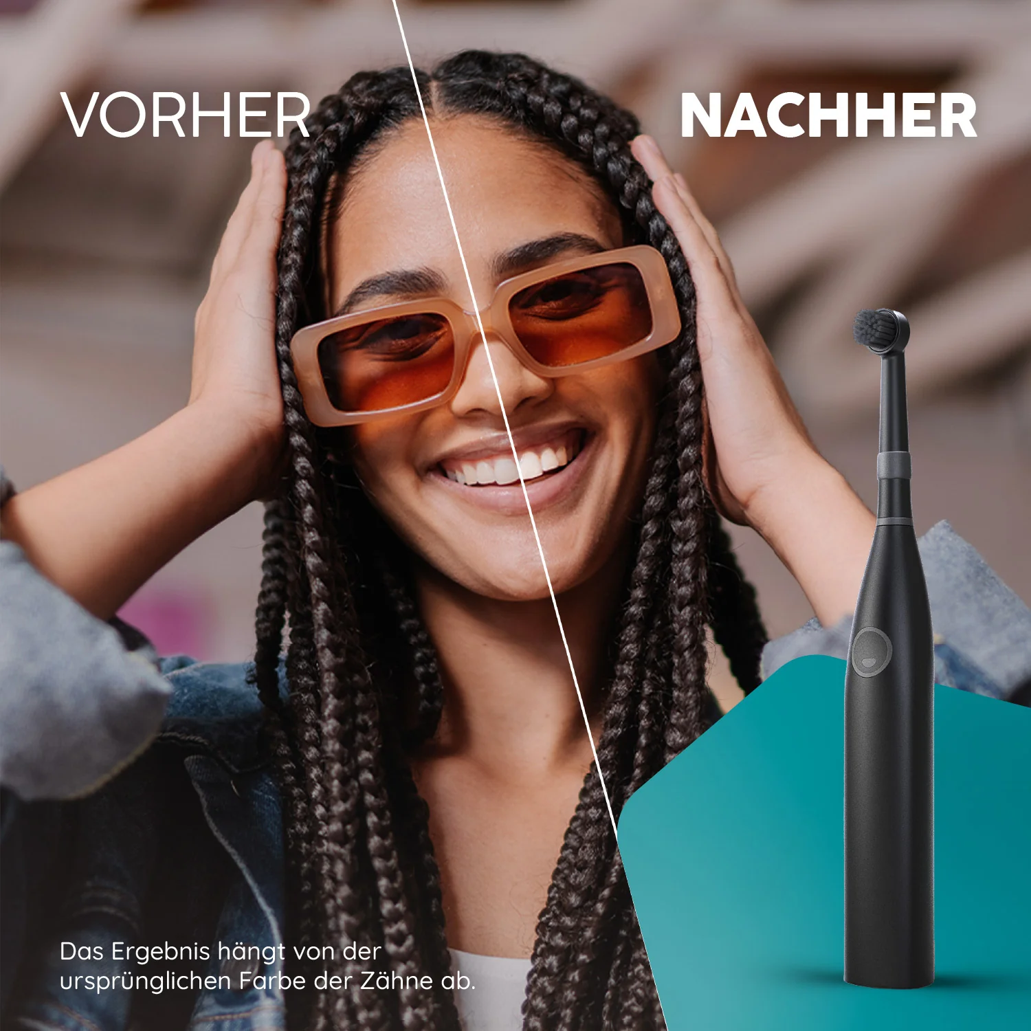 Aufsteckbürsten R2 | Allblack - Image 7